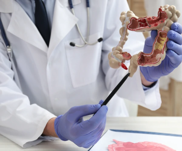 Tratamiento especializado coloproctologia en ensenada bc